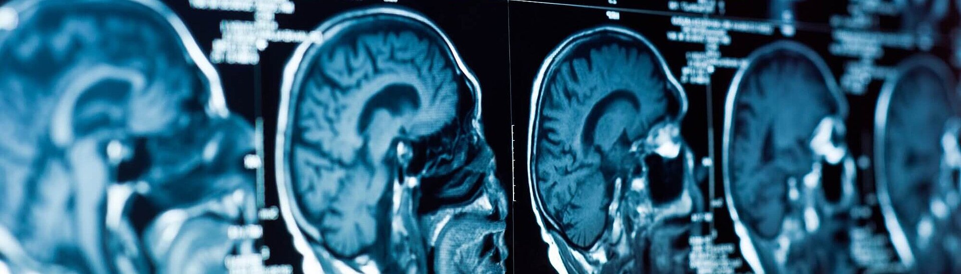 Nonsensitive Drives for Magnetic Resonance Tomography