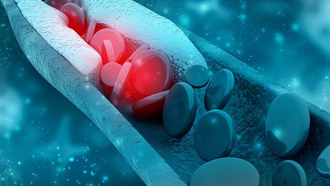 PI Ceramic - Cardiovascular Surgery
